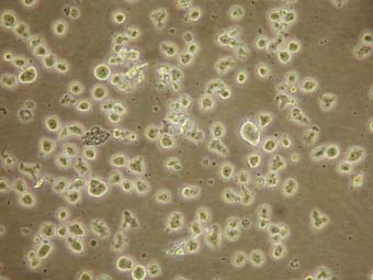 lymphoblastoid cell line